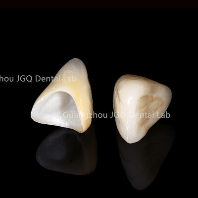 Laboratório Odontológico Personalizado Biocompativel Restaurações de Zirconia FDA CE aprovado