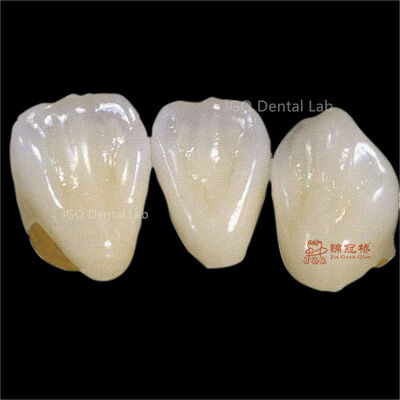 kaufen Polierte glasierte Zirkonoxid reduzierte Plaqueansammlung Klinisch freundliches Design online manufacture