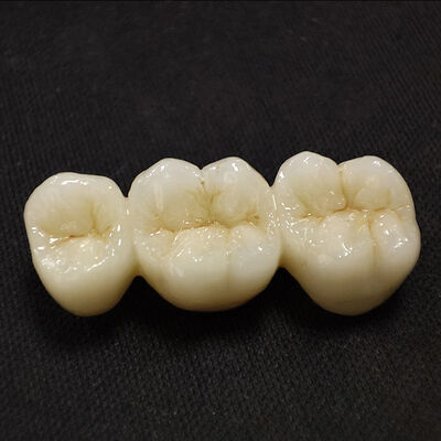 kaufen Individuell gestaltete Zirkonoxid-Dentalbrücke mit 3D-Laserdruck und schneller Bearbeitungszeit online manufacture