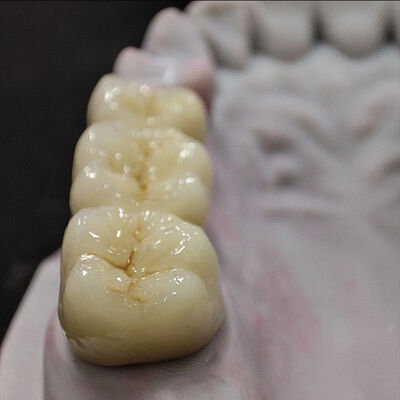 ซื้อ Custom จีนห้องปฏิบัติการฟันมือช่างแต่งครบครันเซรามิกปลายฟรี online manufacture