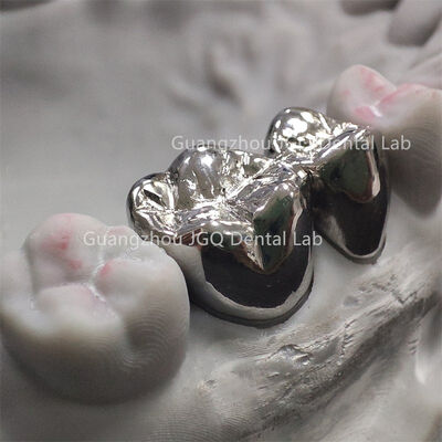 comprare Una corona dentale in metallo da laboratorio dentale cinese online manufacture