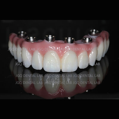 kopen Titanium abutments tandheelkundige implantaten schroef vastgehouden kroon voor tandheelkundige restauratie online manufacture