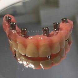 buy Choose China Dental Implants for Permanent and Reliable Solution to Missing Teeth with Wholesale Prices online manufacture