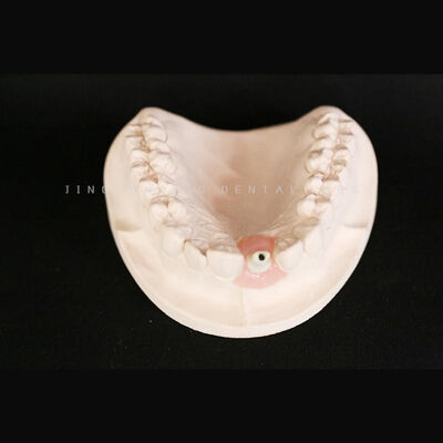 satın al Dental Zirkonya Özel Abutment Laboratuvar Hassas Estetik Titanyum Kadar Güçlü online manufacture