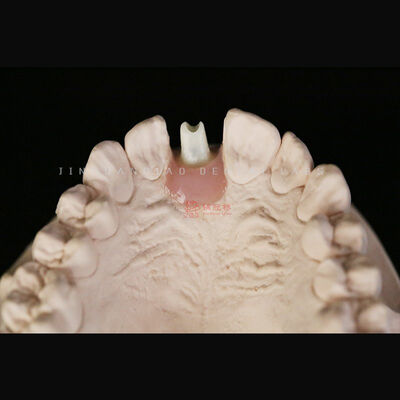 satın al Diş İmplantı Restorasyonları Özel Titanyum Zirkonya Abutment En China Dental Lab online manufacture