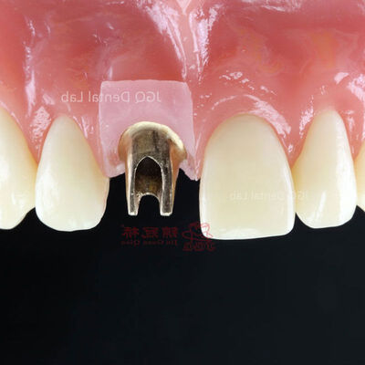 comprar Pilar dental personalizado de titanio y zirconio para restauración dental online manufacture