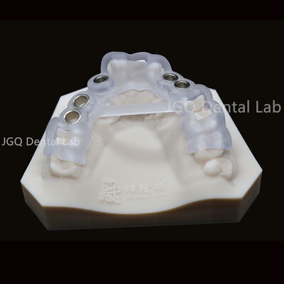 kaufen Maßgefertigte chirurgische Bohrschablone für Zahnimplantate, 3D-Laserdruck online manufacture