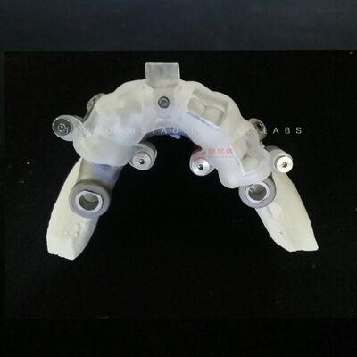 acheter Plaque de guidage chirurgicale numérique supportée par l'impression 3D en laboratoire dentaire en Chine online manufacture
