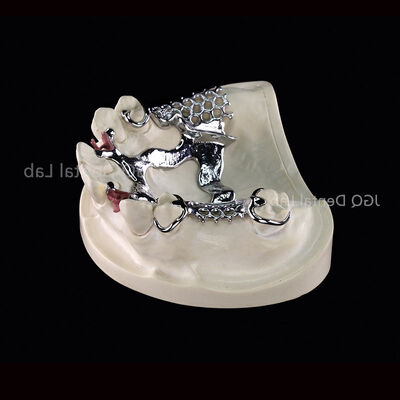 Αγορά 3D εκτύπωση Co Cr Alloy αφαιρούμενο τετράγωνο οδοντοστοιχίας προσαρμοσμένο για την ορολογική αποκατάσταση online manufacture