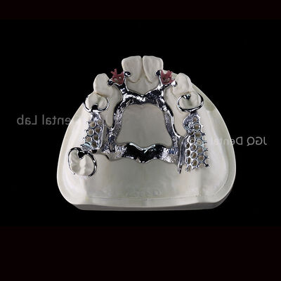 Buy 3D Printing Titanium Dental Framework for Customized Removable Dentures online manufacture