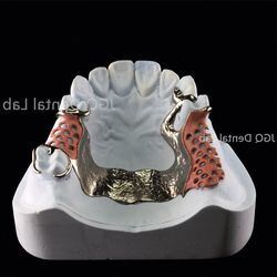 Buy Precise Fit Removable Dentures Metal Framework Customized online manufacture