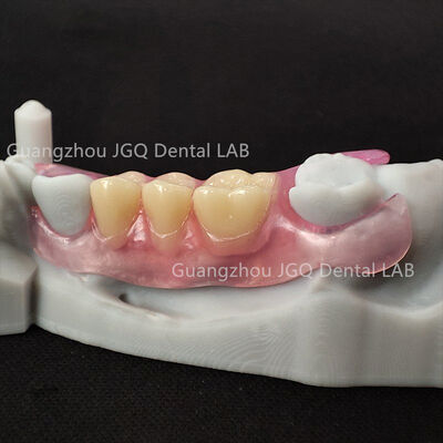 comprar Valplast Dentadura Flexible Material Único Flexibilidad Comodidad Adaptándose a la Boca online manufacture