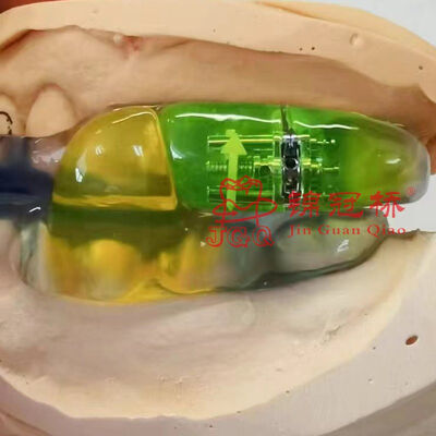 Buy Dental Orthodontic Appliance Lab Denture Shark Anti Snoring Guard for Children Adults online manufacture