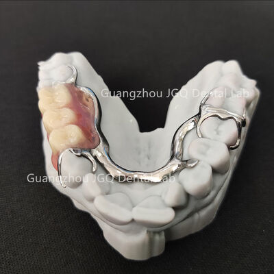 Buy Lightweight Dental Framework Partial Dentures 3D Laser Printing Comfortable online manufacture