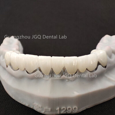 Buy Premium Aesthetic and Functional Zirconia Integrated Dental Restoration Craft online manufacture