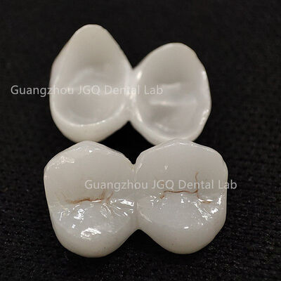 خرید پروتزهای زیرکونیوم تایید شده CE، ساخت آزمایشگاه دندانپزشکی قابل اعتماد online manufacture