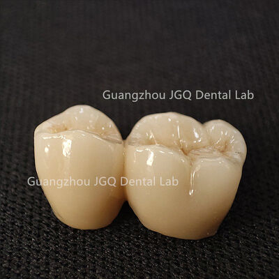 Mua Zirconia phay CNC chính xác Khớp viền chính xác cho mọi trường hợp lâm sàng online manufacture