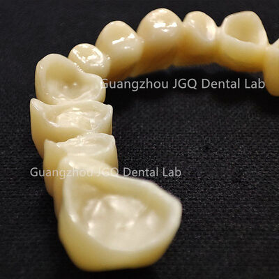 Buy Custom Solid Layered Zirconia Crown Bridge Full Service China Dental Lab online manufacture