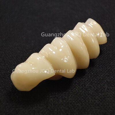 comprar Laboratorio Dental Líder en China Suministra Restauraciones de Zirconia a Granel de Alta Calidad con Servicios de Externalización Confiables online manufacture
