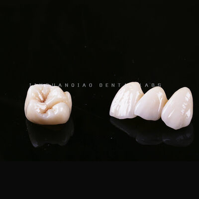 kopen Aanpassing tandheelkundig laboratorium Zirconia kroon brug fabricage Stabiel herstel online manufacture