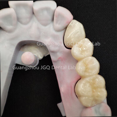 comprar Zirconia a Granel de Alta Pureza 33 Años de Experiencia 11 Laboratorios en Toda China Entrega Rápida online manufacture