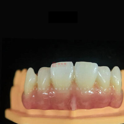 acheter Restaurations en zircone translucide naturelle conçues sur mesure pour les dents antérieures online manufacture