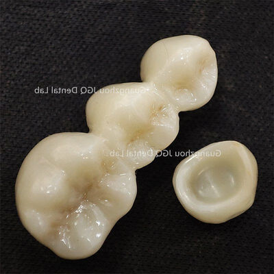 acheter Couronne Pont Dentaire Tout Céramique Laboratoire Aspect Naturel Effet Esthétique online manufacture