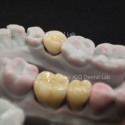 comprar Zirconio a granel 3Shape CAD CAM, ajuste marginal de precisión, laboratorio líder en China online manufacture