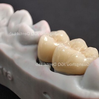 Buy Fracture Proof Zirconia Structure Durable Posterior Dental Restoration online manufacture