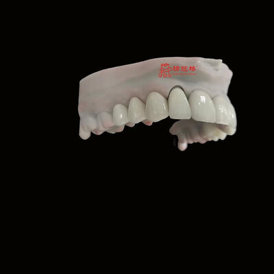 kaufen Erfahrener Dentalhersteller Premium Zirkonoxid-Laborservices online manufacture