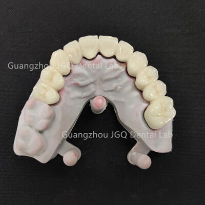kopen 3Shape Digitale Workflow Zirconia Precise Occlusal Alignment Technologie JGQ Tandheelkundig Lab Custom Zirconia Restoration online manufacture