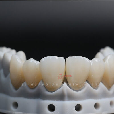 acheter Couronne Pont en Zircone Médicale Fraisée CNC Esthétique Stratifiée Délai Rapide Certifié FDA CE online manufacture