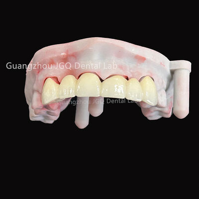 comprar Aprobación de la FDA CE Restauración de zirconia Fabricación CNC a medida Producción rápida online manufacture