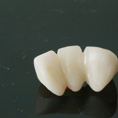 comprare Corona e ponte in zirconio adatti per il bruxismo, ad alta resistenza, fabbricazione in laboratorio CNC online manufacture