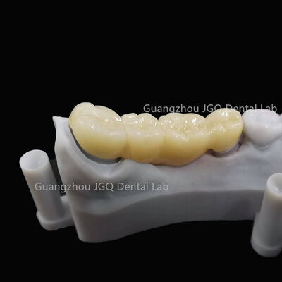 comprar Materiais Dentários Certificados Fabricados em CNC de Zircônia de Alta Resistência Personalizada online manufacture