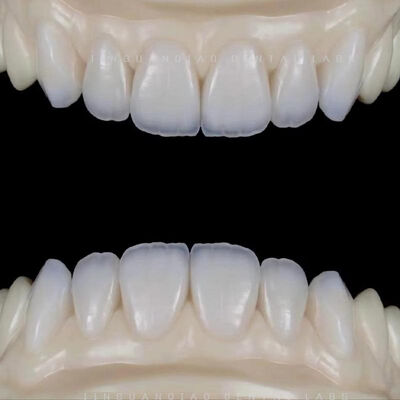 ซื้อ ครอบฟันและสะพานฟันเซอร์โคเนียเกรดทางการแพทย์ ผลิตอย่างแม่นยำโดยแล็บทันตกรรมมืออาชีพ online manufacture