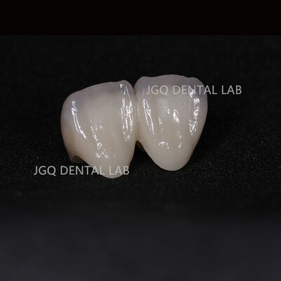 acheter Couronne en zircone stratifiée personnalisée avec correspondance parfaite des teintes pour les dents antérieures cosmétiques online manufacture