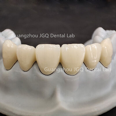 comprar Prótesis de zirconia personalizada de alta resistencia fabricada por CNC con respuesta rápida online manufacture