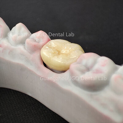 kupować Naturalnie wyglądająca warstwowa odbudowa cyrkonowa o wysokiej trwałości, szybka produkcja w laboratorium dentystycznym online manufacture