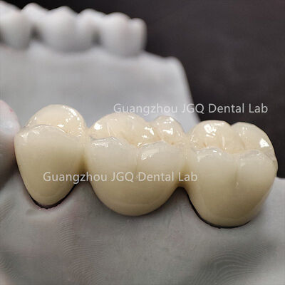 kopen Custom Dental Lab Zirconia Crown Bridge Volledig anatomisch ontwerp Hoge nauwkeurigheid Snelle levering online manufacture