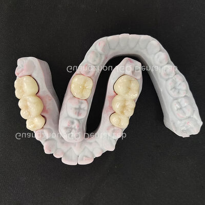 kupować Warstwowa estetyczna korona cyrkonowa z idealnym dopasowaniem brzegów, precyzyjnie frezowana CNC, wykonana na zamówienie online manufacture