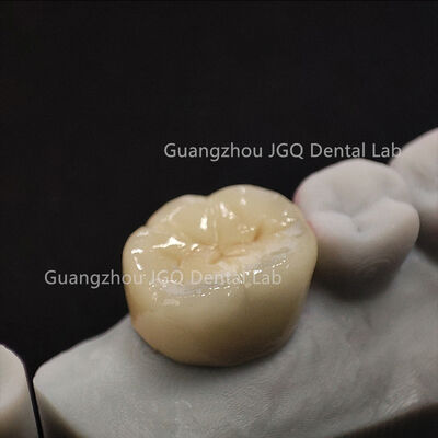 comprar Coroa de Zircônia Laminada de Ajuste Rápido Perfeito Laboratório Odontológico Prótese Dentária de Boa Qualidade online manufacture