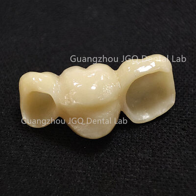 comprar Coronas de Zirconio Monolítico Dentaduras CAD/CAM 1200 MPa Resistencia a la Flexión para Puentes Dentales online manufacture