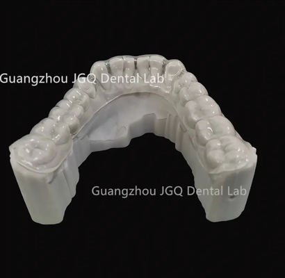 Buy Dental Orthodontic Appliance Lab Night Guard Occlusal Splint online manufacture