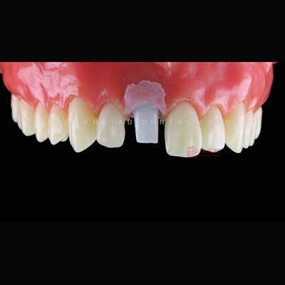 kupować Zastosowane China Dental Laboratory Milling Service Titanium Zirconia Implanty zębowe Abutment online manufacture