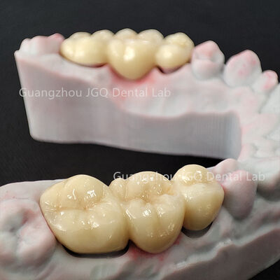 comprar Mejores proveedores de productos dentales OEM fresado Impresión 3D corona de zirconia con encías online manufacture
