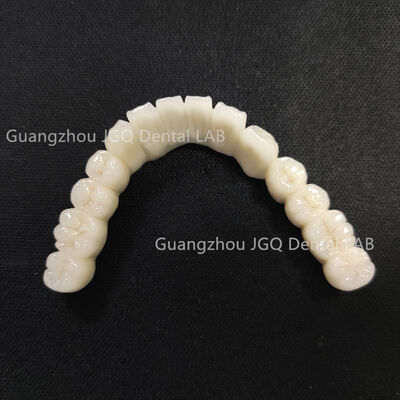 kupować Korona porcelanowa na podbudowie metalowej stop kobaltowo-chromowy realistyczny kolor twarda tekstura online manufacture