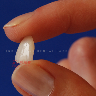 Купить Ламинат Ivoclar Emax лощит лабораторию Китая высокого Translucency зубоврачебную online manufacture