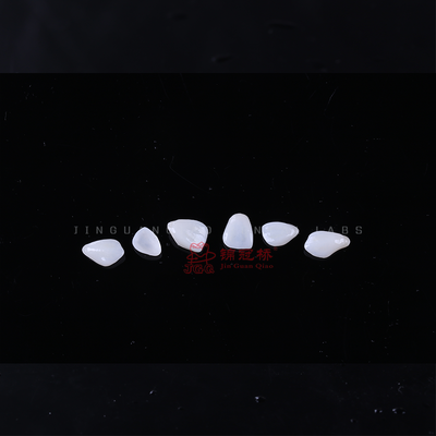 Buy Digital Empress Denture Porcelain Emax Veneers by Dental Prosthesis Laboratory online manufacture