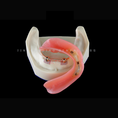 comprare Protesi rimovibile in cromo-cobalto con attacchi fresati di precisione e denti in resina acrilica online manufacture